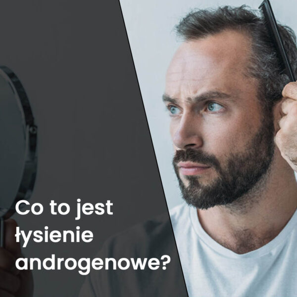 co to jest łysienie androgenowe?